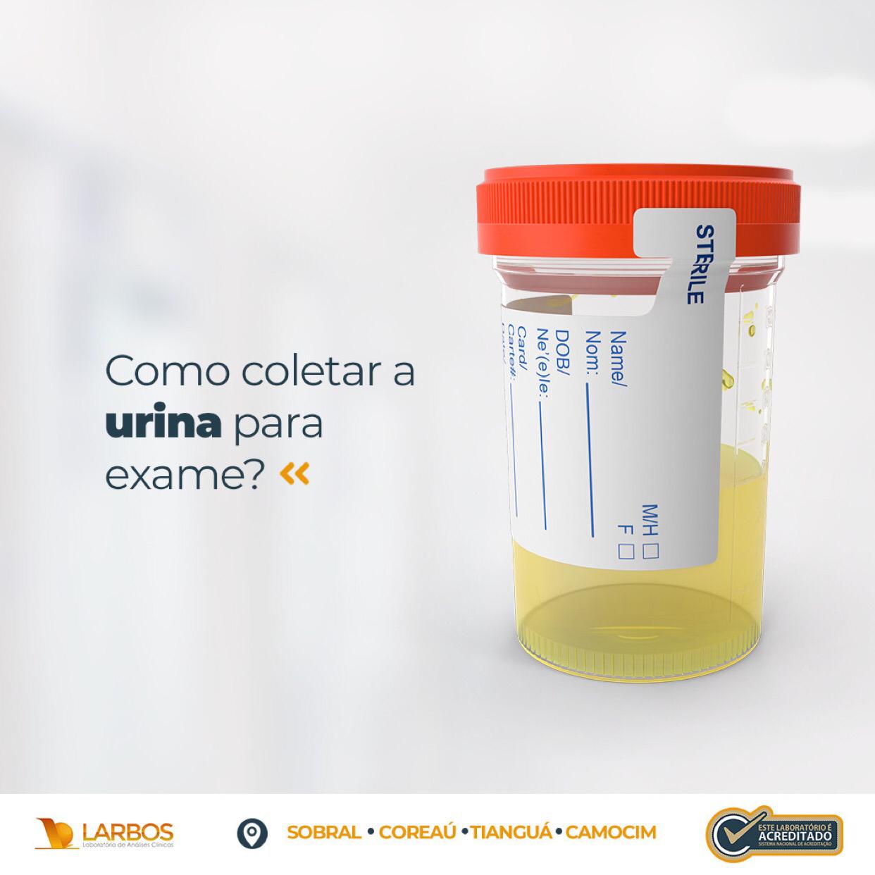 Eliminare Cheaguri De Sange In Urina CAMOCIM ONLINE: EXAME DE URINA - SAIBA COMO COLETAR