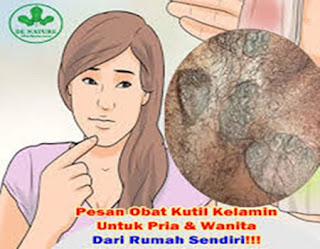 Kutil kelamin atau kutil di kemaluan pada kehamilan, obat kutil kelamin yg mujarap, kutil kelamin di labia minora, mengobati kutil kelamin atau kutil di kemaluan dengan bawang putih, obat kutil kelamin atau kutil di kemaluan luar alami, jual obat penghilang kutil kemaluan, obat kutil kelamin atau kutil di kemaluan luar tanpa operasi, obat kutil kelamin atau kutil di kemaluan yg mujarap, cara menghilangkan kutil kelamin wanita, menghilangkan virus kutil kelamin, obat kutil kelamin atau kutil di kemaluan untuk orang hamil