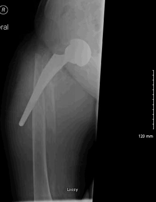 Interesting Topics in Orthopedic Surgery by Dr. Nasar June 2016