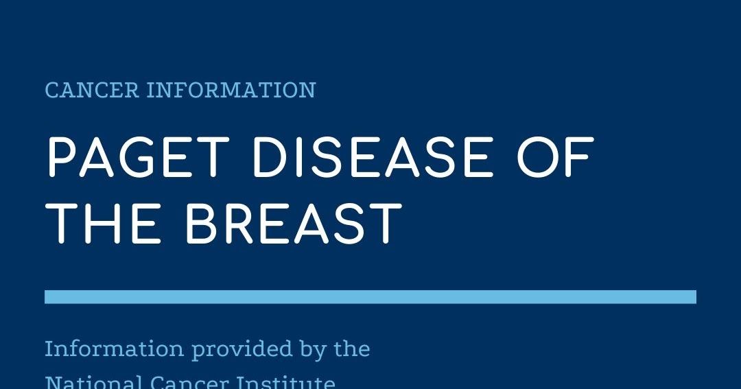 Paget Disease of the Breast (Fact Sheet) National Cancer Institute