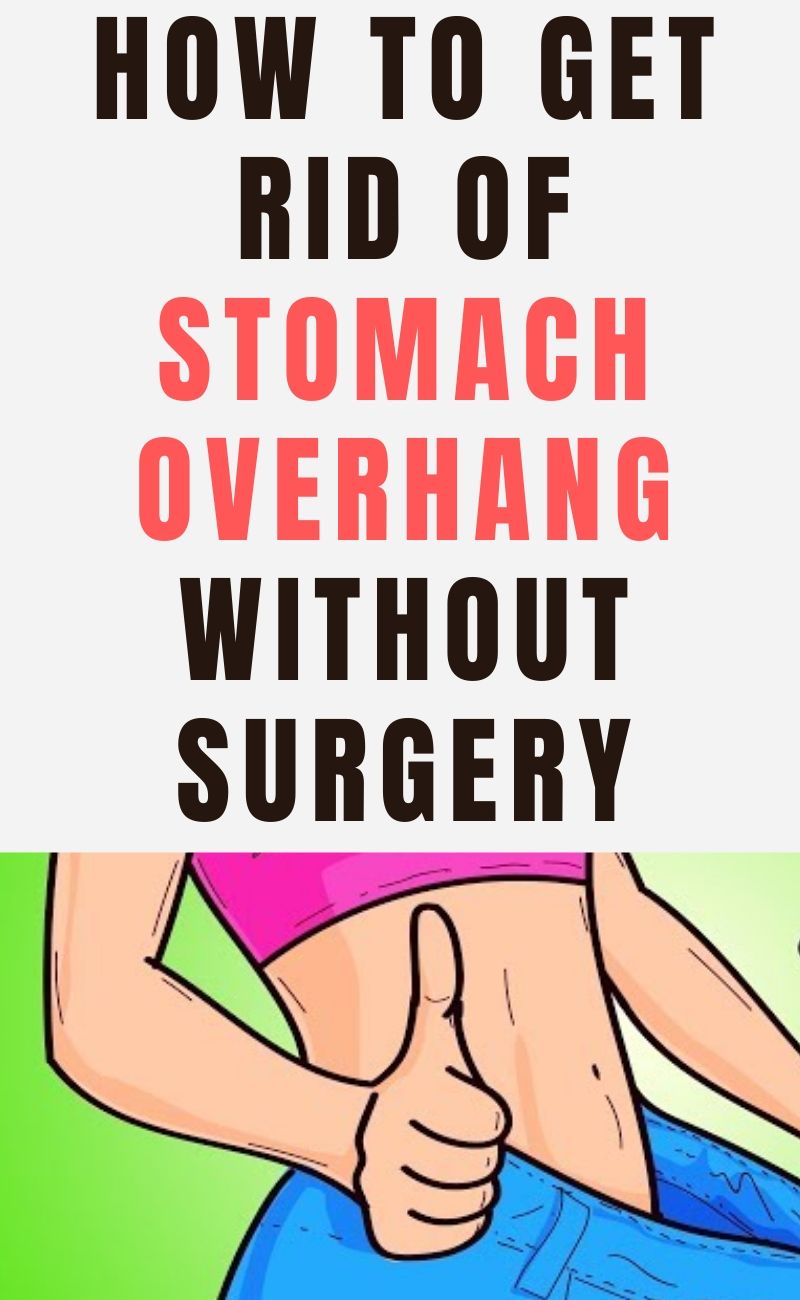 10 Tips On How To Get Rid Of Stomach Overhang (Without Surgery
