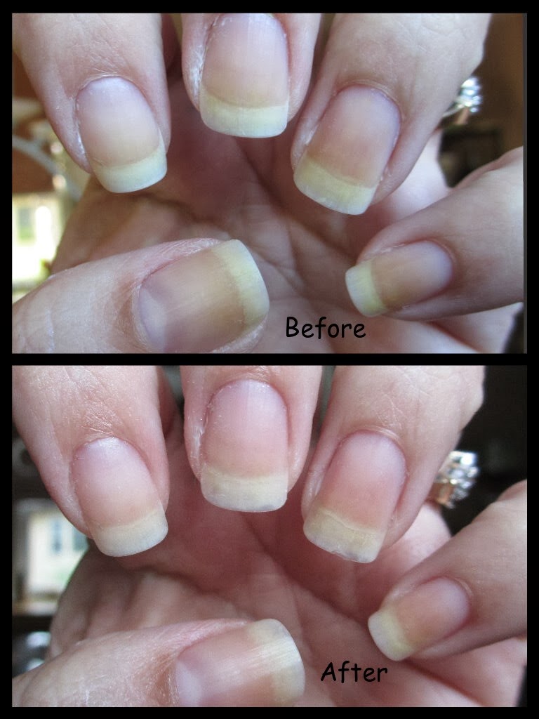 Cha Cha Cakes Nails Nail Whitening Products Bubble White vs. Denture