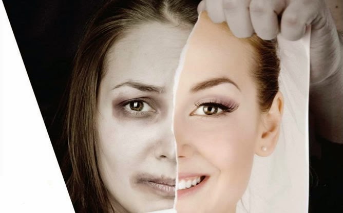 indefension aprendida