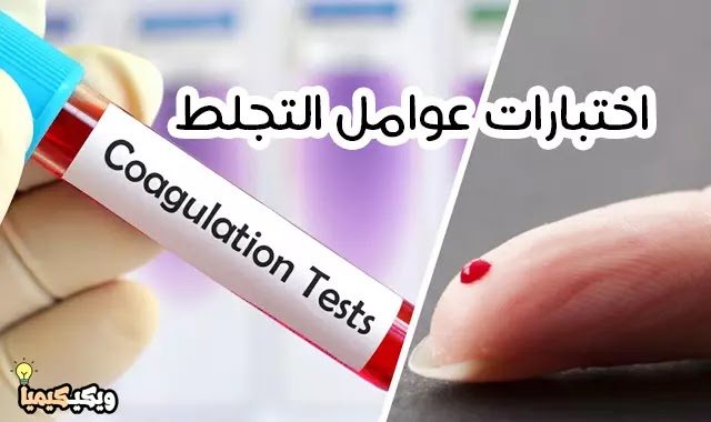 تحاليل تجلط الدم coagulation factor test