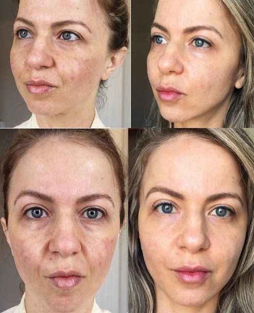 Comment unifier le teint et réduire les taches brunes? masque aloe vera et citron