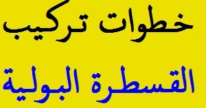 مضاعفات القسطرة البولية بمصعد اللوتس للنساء Comertinsaat Com