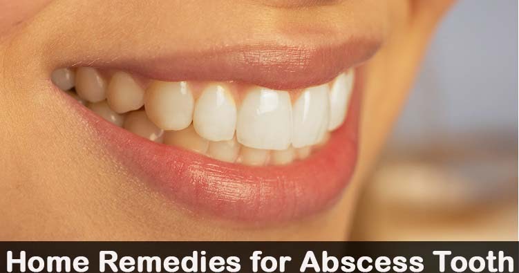 Natural Home Remedies for Dental Abscess How to Care for