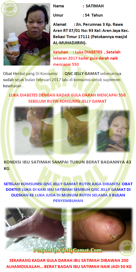 Cara Mengobati Luka Diabetes Basah Secara Alami Terbukti Mujarab ~ Testimoni QNC JELLY GAMAT Cara Mengobati Luka Diabetes Basah Secara Alami Terbukti Mujarab ~ Testimoni QNC JELLY GAMAT