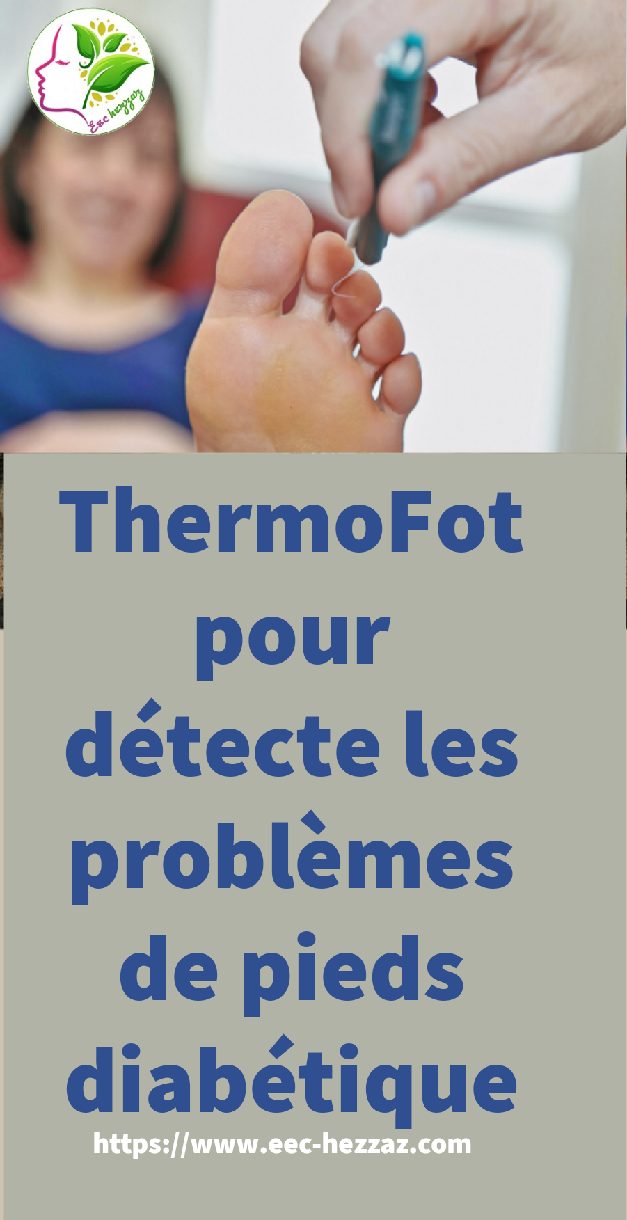 ThermoFot pour détecte les problèmes de pieds diabétique