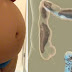 Feel Bloated? This is Why and What You Should Do to Relieve Constipation and Bloating