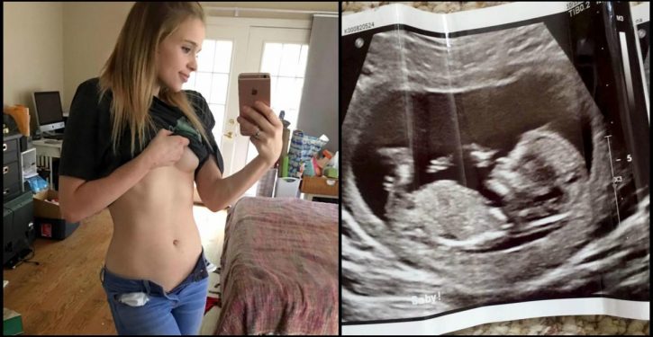 This Girl Claims To Be 6 Months Pregnant, But No One Believes Her By Seeing Her Belly