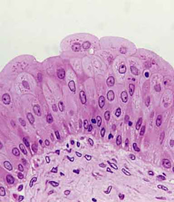 Perhatikan sel berbentuk kubah sepanjang tepi. Ini adalah epitel transisi yang bisa dilihat baik dalam kandung kemih maupun ureter. 
