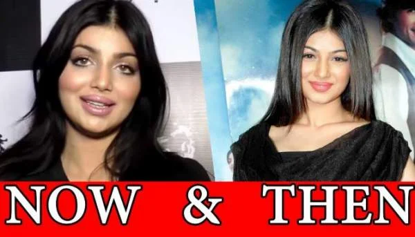 आयशा टाकिया plastic surgery now and then