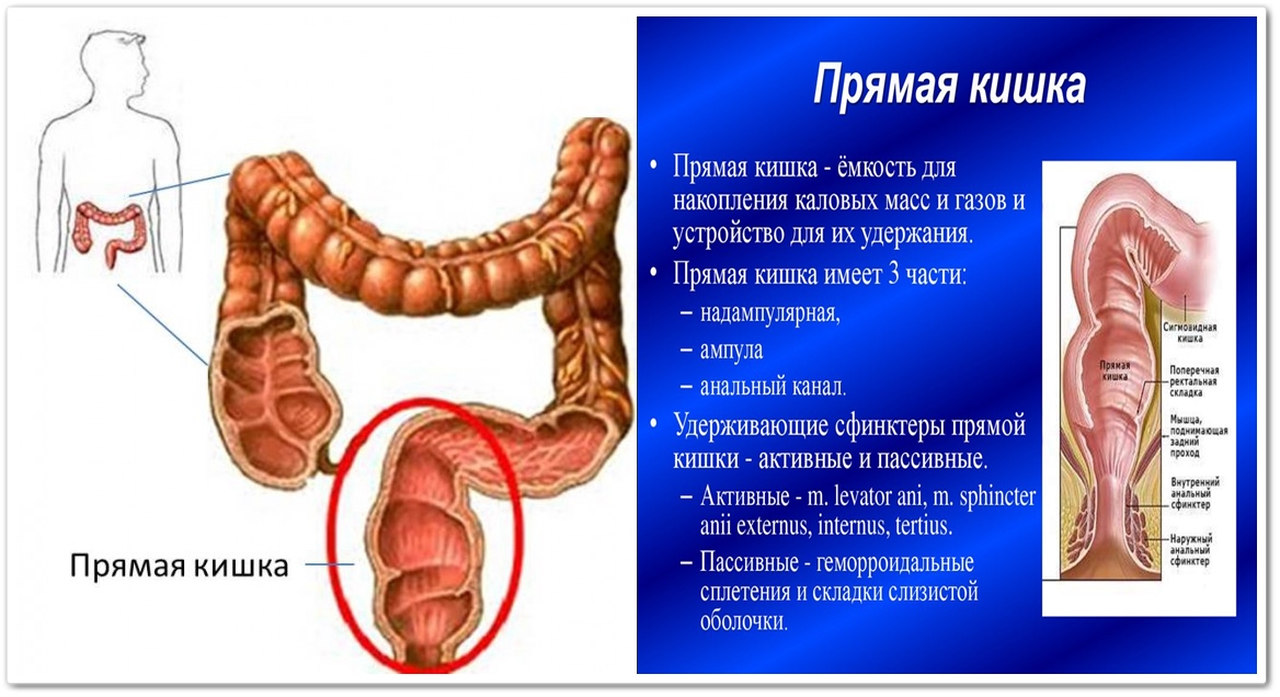 Прямая кишка отделы анатомия. Утолщение прямой кишки что это. Наружный сфинктер заднего прохода анатомия. Утолщение стенки тонкой кишки. Утолщение прямой кишки что это.
