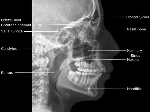 Medical and Health Science: Facial Bones Radiographic Anatomy