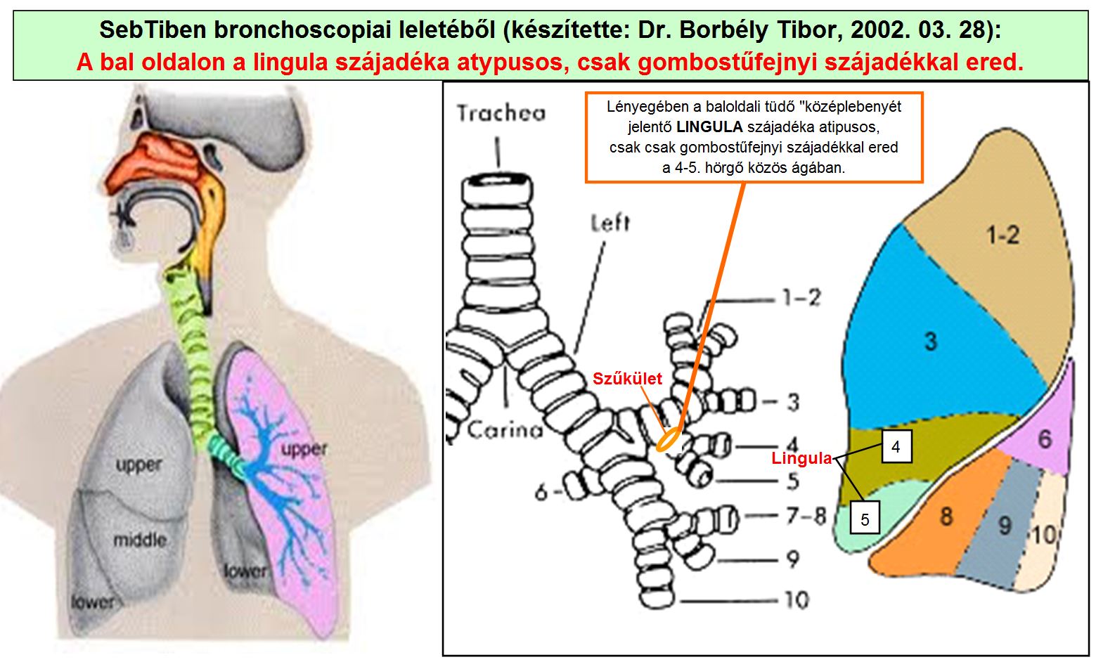 kortikoszteroid