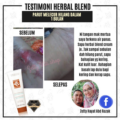 Testimoni Herbal Blend Cream