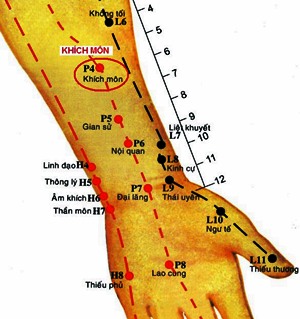 Vị trí huyệt khích môn