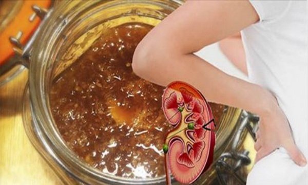 2 Teaspoons Of This Ancient Remedy And Say Goodbye To Gastritis, Constipation And Kidney Stones