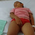 Criança com insuficiência renal crônica precisa de ajuda com alimentos, medicação e consultas