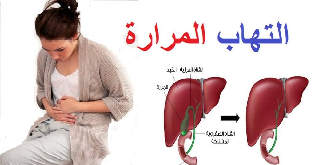 رجيم المرارة الملتهبة أكلات تناسب مرضى المرارة