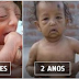 GAROTINHO DE " 80 ANOS" É O "BENJAMIN BUTTON" DA VIDA REAL