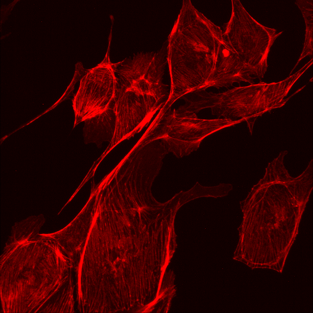 Red fluorescence captured under the Etaluma Lumascope 620 microscope.