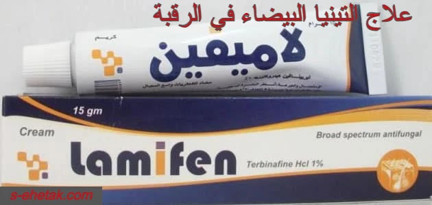 علاج التينيا البيضاء في الرقبة علاج التينيا البيضاء في الرقبة