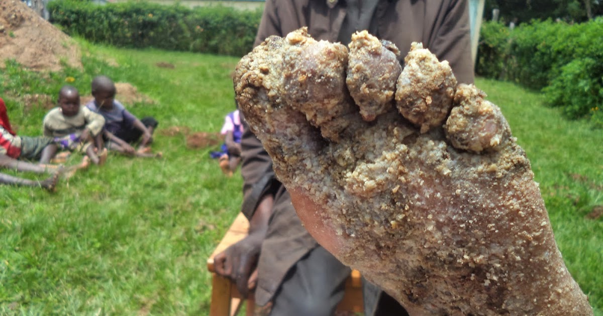 different types of jiggers