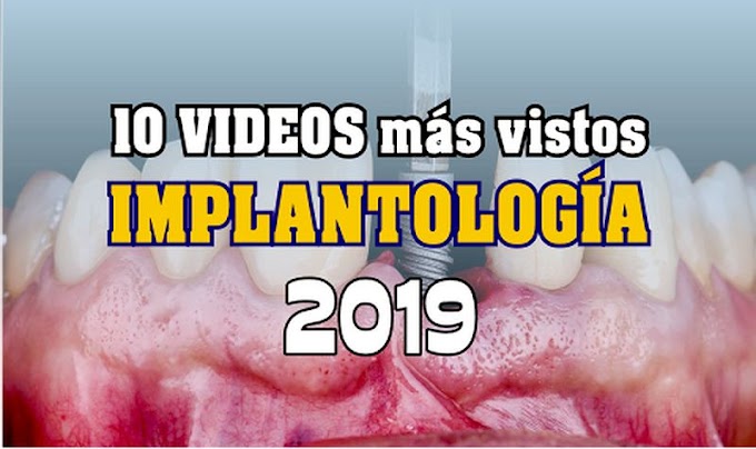 10 Videos de IMPLANTOLOGÍA más vistos en el 2019