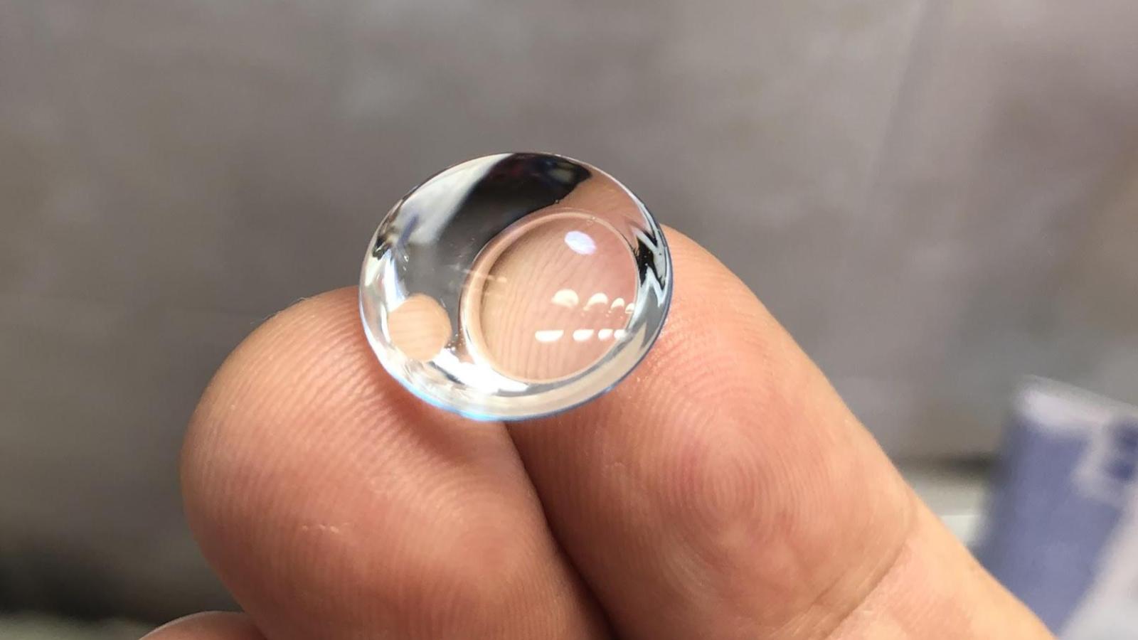 From Mexico with Keratoconus Two Years with Scleral Lenses