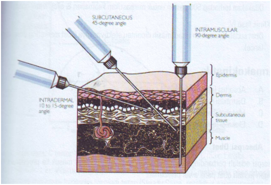 Teknik Pemberian Obat Secara Oral Sublingual Parentral Dan Anal Wiranti
