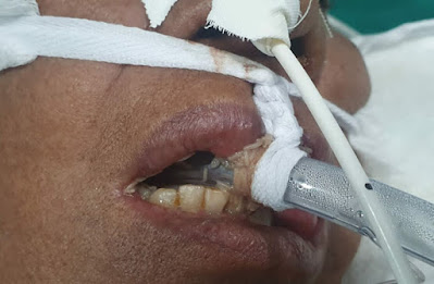 IMAGEM FORTE - Hospital de Campanha da Zona Leste é insalubre e não atende à legislação da Enfermagem 2 IMAGEM FORTE - Hospital de Campanha da Zona Leste é insalubre e não atende à legislação da Enfermagem