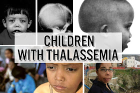 Penderita Penyakit Thalasemia