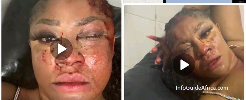 Graphic Photos Of Actress, Angela Okorie After She Was Attacked By Armed Robbers