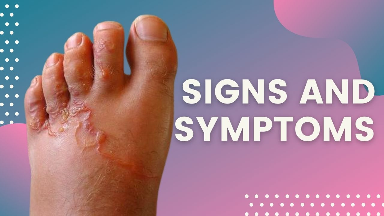 what-is-babesiosis-causes-and-signs-of-babesiosis