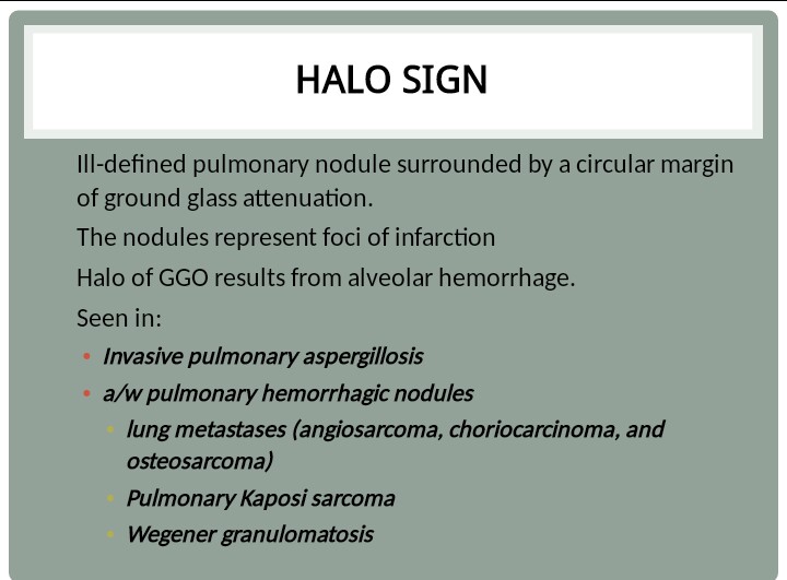 Halo Meaning : Definition of Halo 