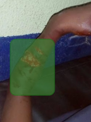 woman cuts stepdaughter hand