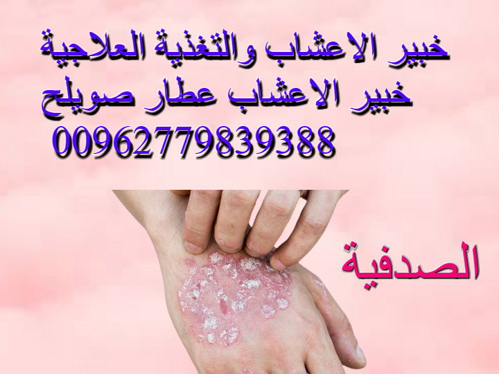 بعشبة موجودة كل بيت يعالج الأشنة في 3 أيام التجربة أمامك يجيب على أسئلتك الأشنة الجلدية على اليوتيوب