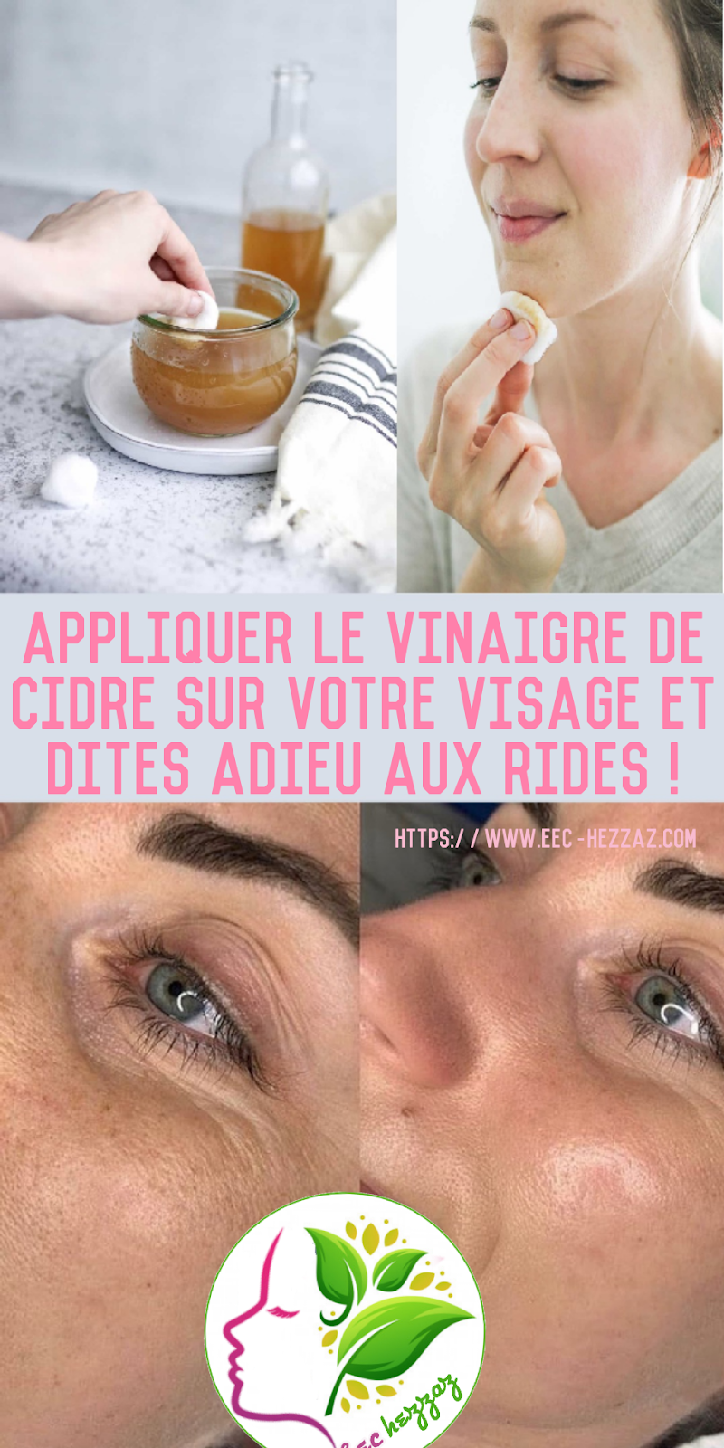 Appliquer le vinaigre de cidre sur votre visage et dites adieu aux rides !