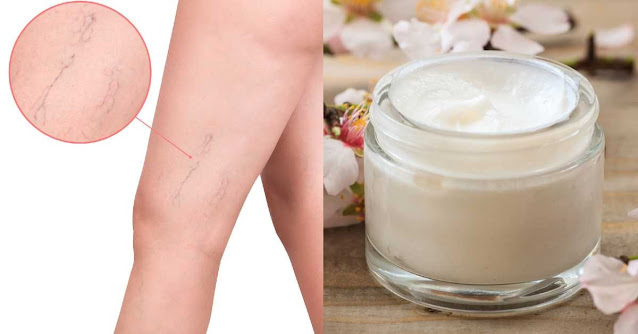 Crème pour améliorer la circulation des jambes : réduit les picotements et les lourdeurs