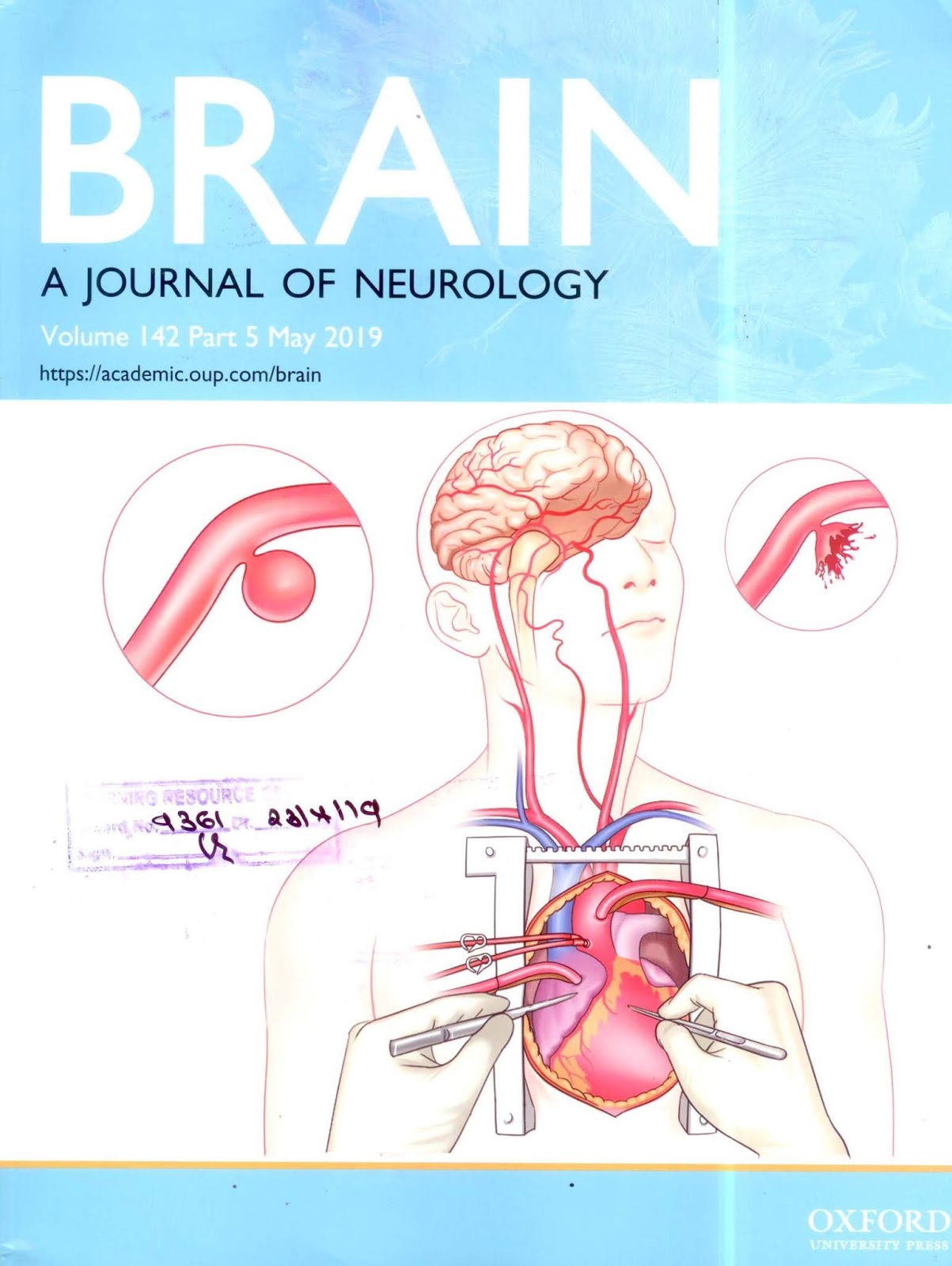 https://academic.oup.com/brain/issue/142/5