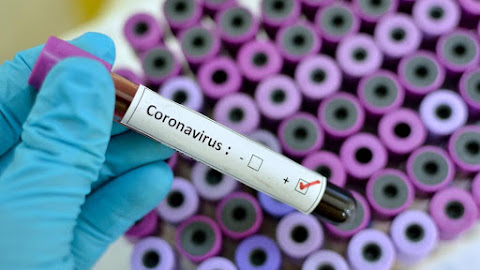 Koronavirüs (COVID-19) hastalığı tedavisi