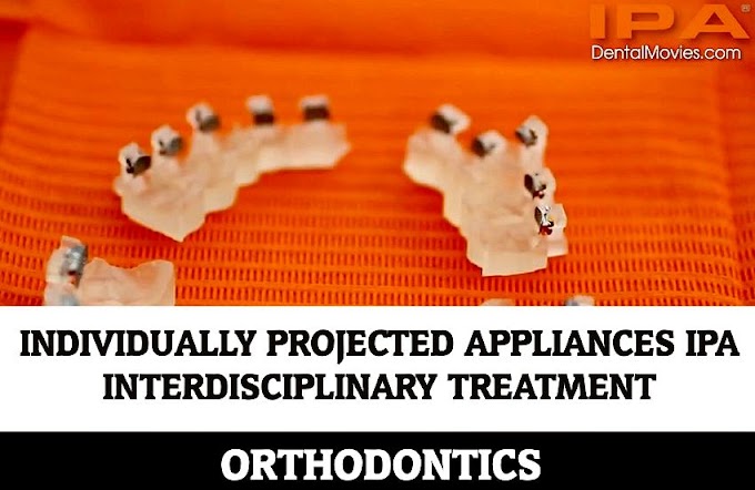 ORTHODONTICS: Individually Projected Appliances IPA - Interdisciplinary Treatment