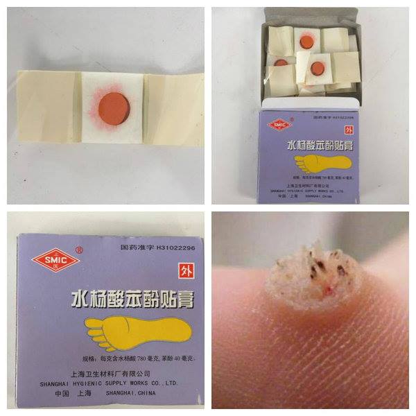 koyo kutil plester kutil mata ikan ji yan gao z0073a uyestore koyo kutil plester kutil mata ikan ji yan gao z0073a uyestore