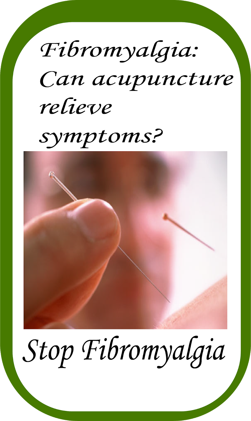 Fibromyalgia Can acupuncture relieve symptoms?