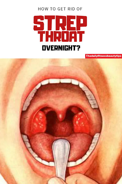 strep throat treatment