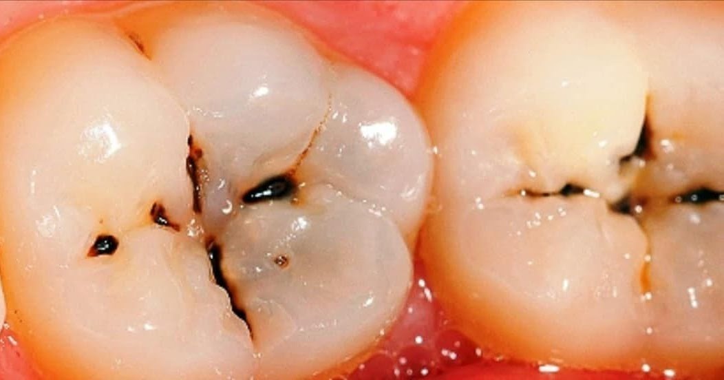 Cirujano Oral, Estética y Armonización