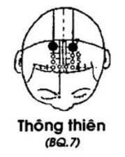 Vị trí huyệt thông thiên