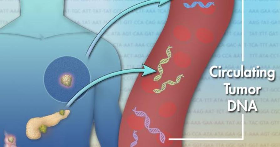 Metastatic Liver Cancer Prognosis Life Expectancy CancerOz